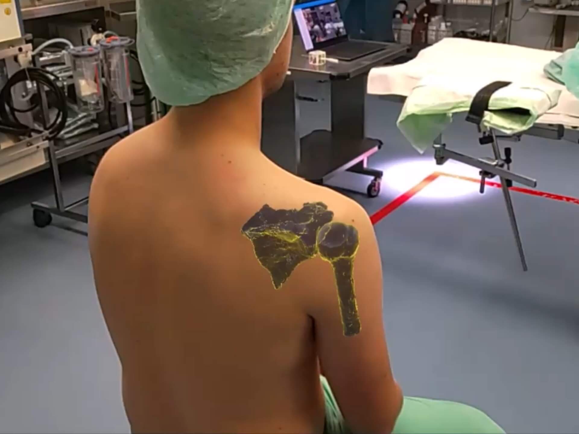 Through the look into a AR device bones can be shown which can doctors extremely help